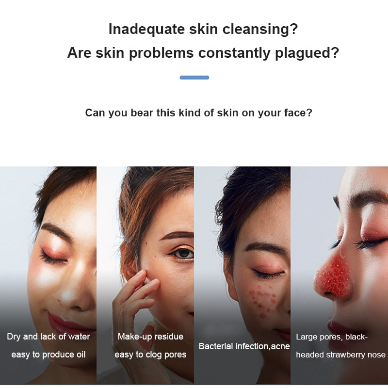 Electric OXY Blackhead Remover - Xvogue