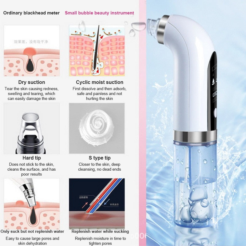 Electric OXY Blackhead Remover - Xvogue