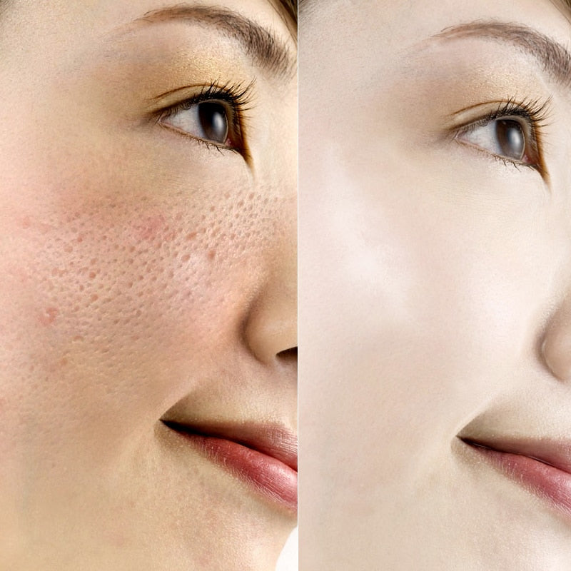 Hyaluronic Acid Face Serum Anti-Aging Shrink Pore Whitening Moisturizing Essence Face Cream - Xvogue