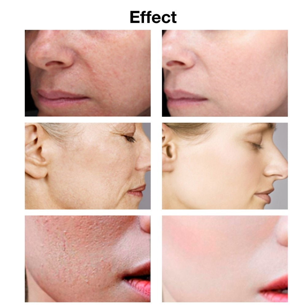 Hyaluronic Acid Face Serum Anti-Aging Shrink Pore Whitening Moisturizing Essence Face Cream - Xvogue
